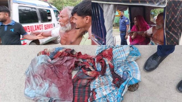ছুরিকাঘাত জমিজমা বিরোধে বড় ভাইয়ের ছুরিকাঘাতে ছোট ভাই আহত