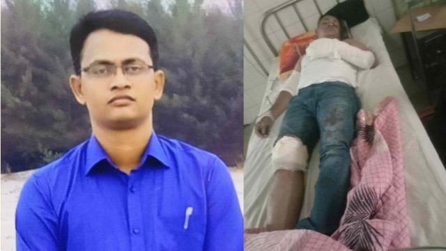 চাঁপাইনবাবগঞ্জে ৯৯৯-এর কলে ডাকাত ধরতে গিয়ে হামলার শিকার পুলিশ কর্মকর্তা
