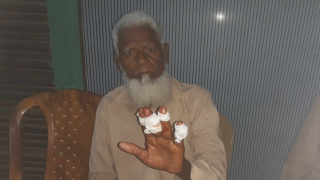 শিবগঞ্জে নানা শশুরকে মেরে রক্তাক্ত করার অভিযোগ নাতি-জামাইয়ের বিরুদ্ধে